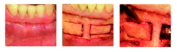 Реферат: Лазеры в стоматологии