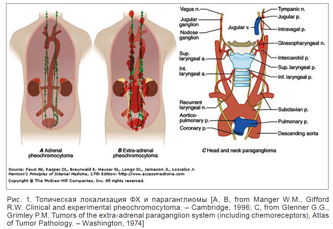 Доклад по теме Феохромоцитома