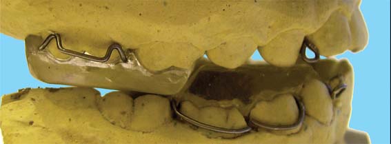 Осциллятор тізбектерін блоктау Осциллятор тізбектерін блоктау